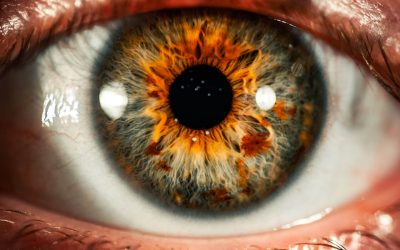 What is a Recurrent Corneal Erosion and How is it Treated?