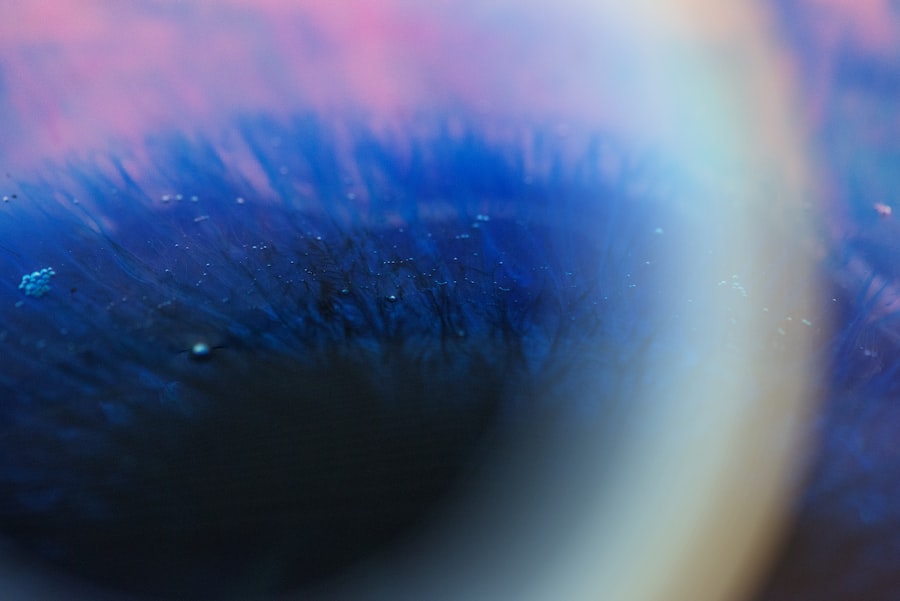 scleral lenses