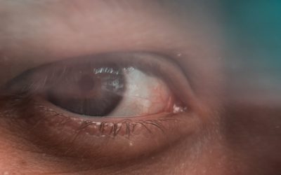 The science behind myopia control in children