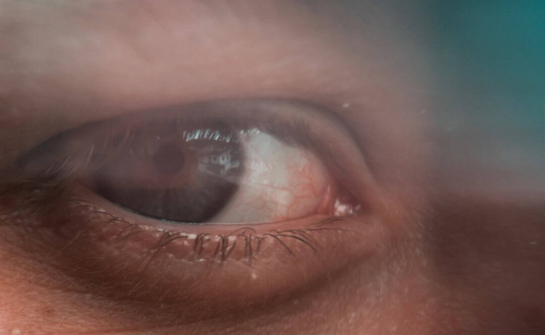 The science behind myopia control in children