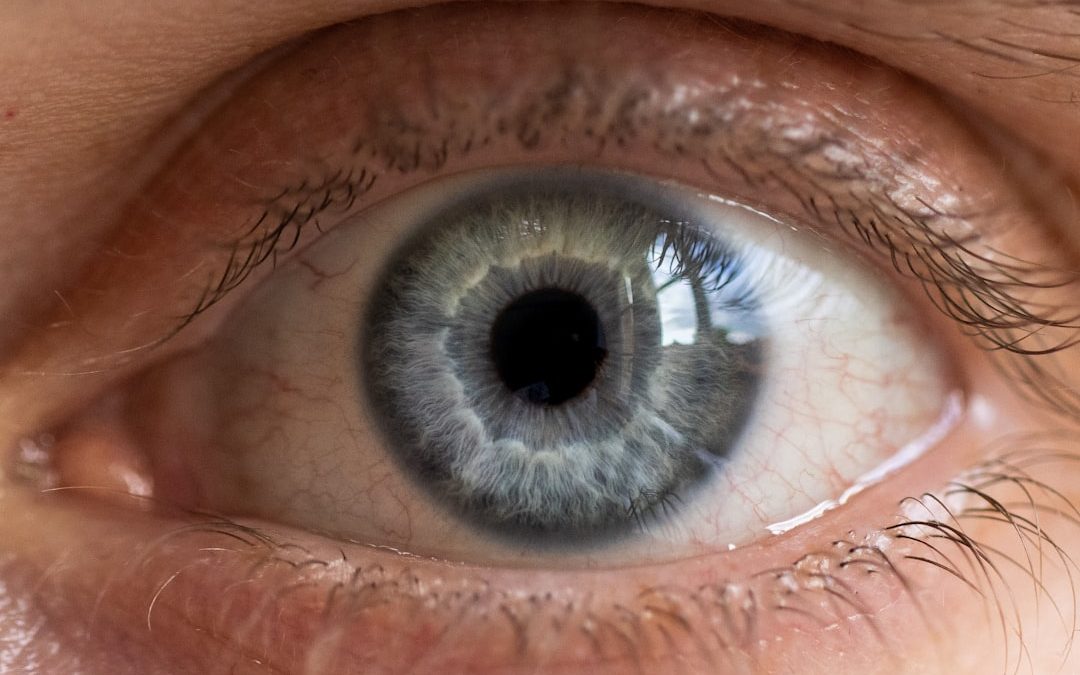 Managing eye allergies while wearing contact lenses