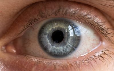 Managing eye allergies while wearing contact lenses
